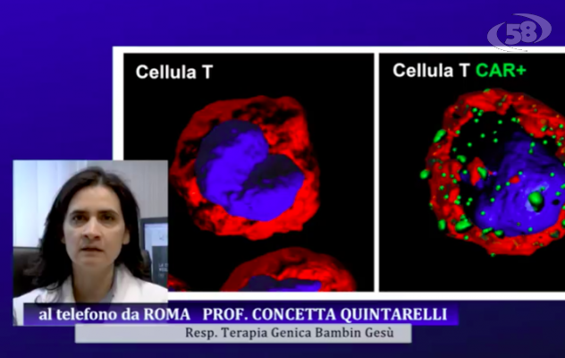 Leucemia e terapia genica, nuove scoperte scientifiche