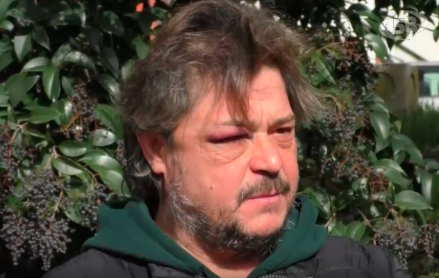 Della Pia: ''Picchiato dalla Polizia'' /INTERVISTA. La versione della Questura