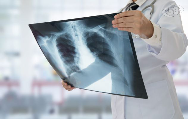 I radiologi sono tutti malati: Asl costretta a sospendere il servizio