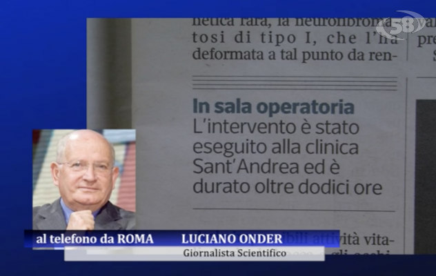Primo trapianto del viso a Roma: le frontiere della medicina