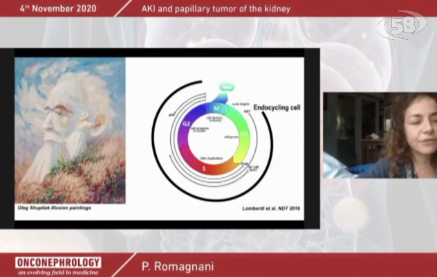  La onconefrologia, una nuova branca della medicina in continua evoluzione: il webinair di Biogem