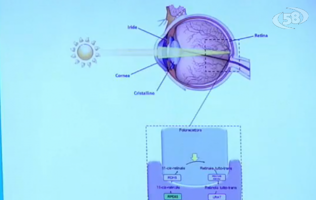 Malattia ereditaria della retina, studio rivoluzionario del Vanvitelli/VIDEO