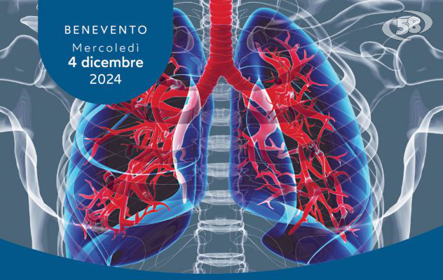 Gestione del paziente in ventilazione meccanica, focus al San Pio
