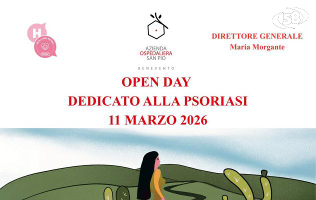 Psoriasi, visite e screening gratuiti al San Pio. Morgante: "Prevenzione fondamentale"