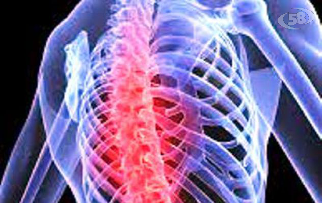 Prevenzione e cura dell'osteoporosi, sabato convegno a Mirabella 